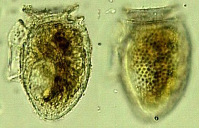 Mikroskopaufnahme der giftigen Flügelpanzerflagellat Dinophysis