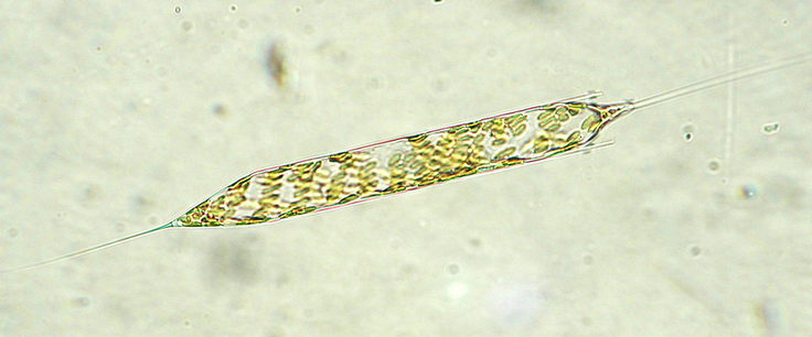 Unter dem Mikroskop werden Plaktonarten wie Rhizosolenia, eine in der Nordsee häufig vorkommende Kieselalge, sichtbar (Bild: Kerstin Kolbe/NLWKN).